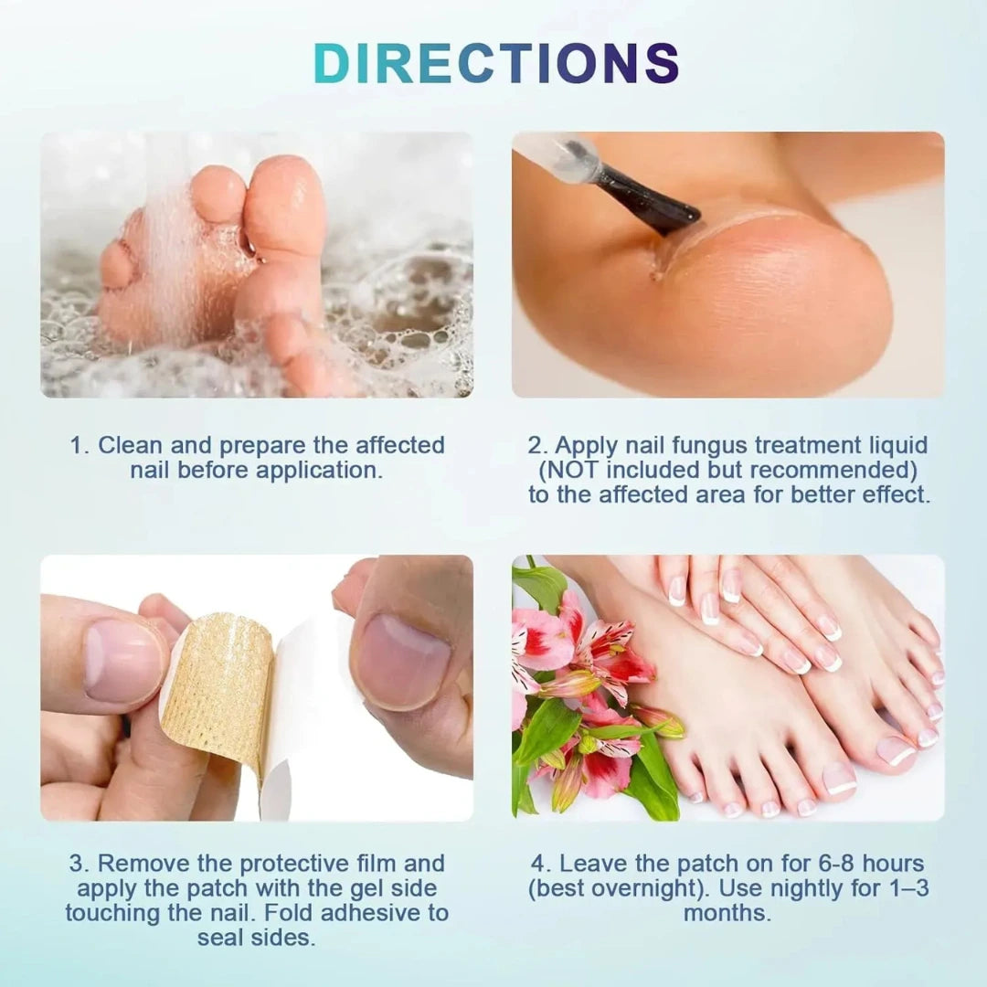 NailHeal™ - Fungal Nail Patches | Pack Of 10 | BUY 1 GET 1 FREE